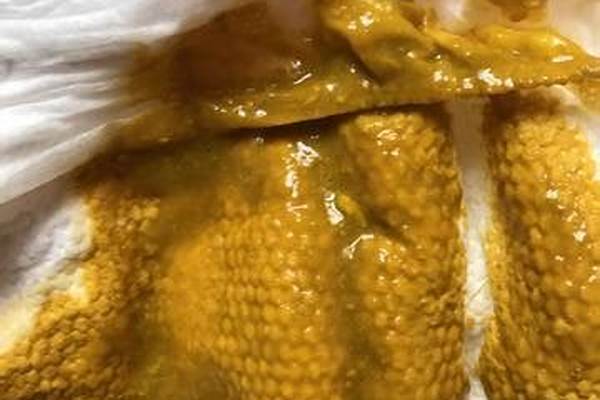 两个月宝宝拉屎带水怎么回事