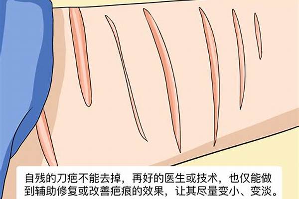 刀疤怎么去掉不留痕迹